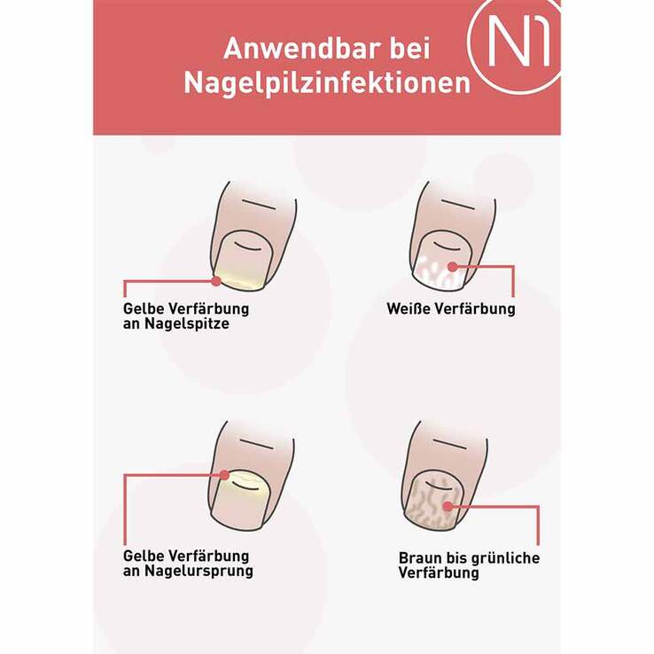 N1 Nagelpilz Lösung, 10 ml