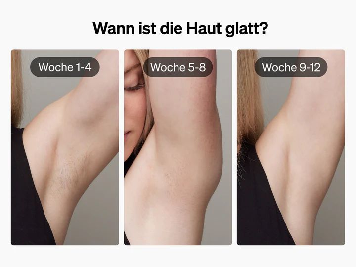 Ulike IPL-Haarentferner Air 3 Lila IPL Gerät