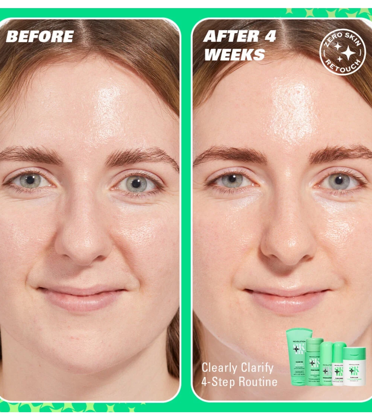 Revolution Skin - *Clearly Clarify* - Sérum facial clareador 10% niacinamida Serum Supreme