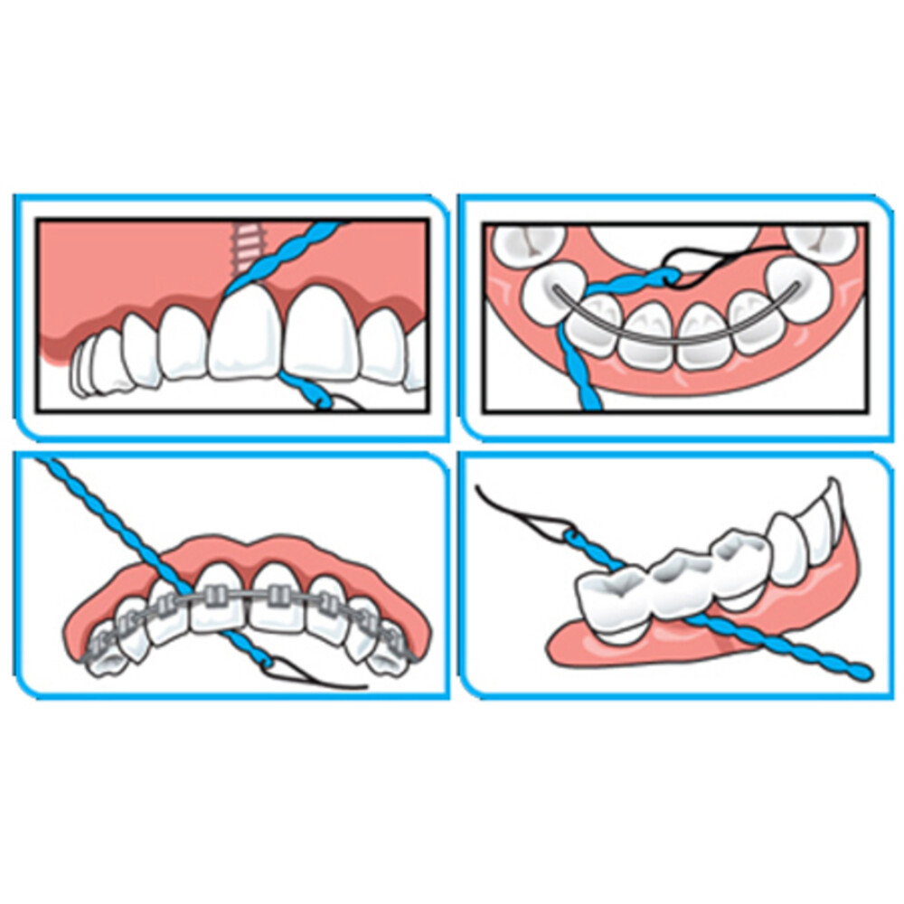 iDontix X-Floss Lite30 stuks