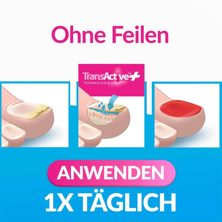 Excilor Nagelpilz intensiv Color 30 ml + 8 ml Kombi., 1 P