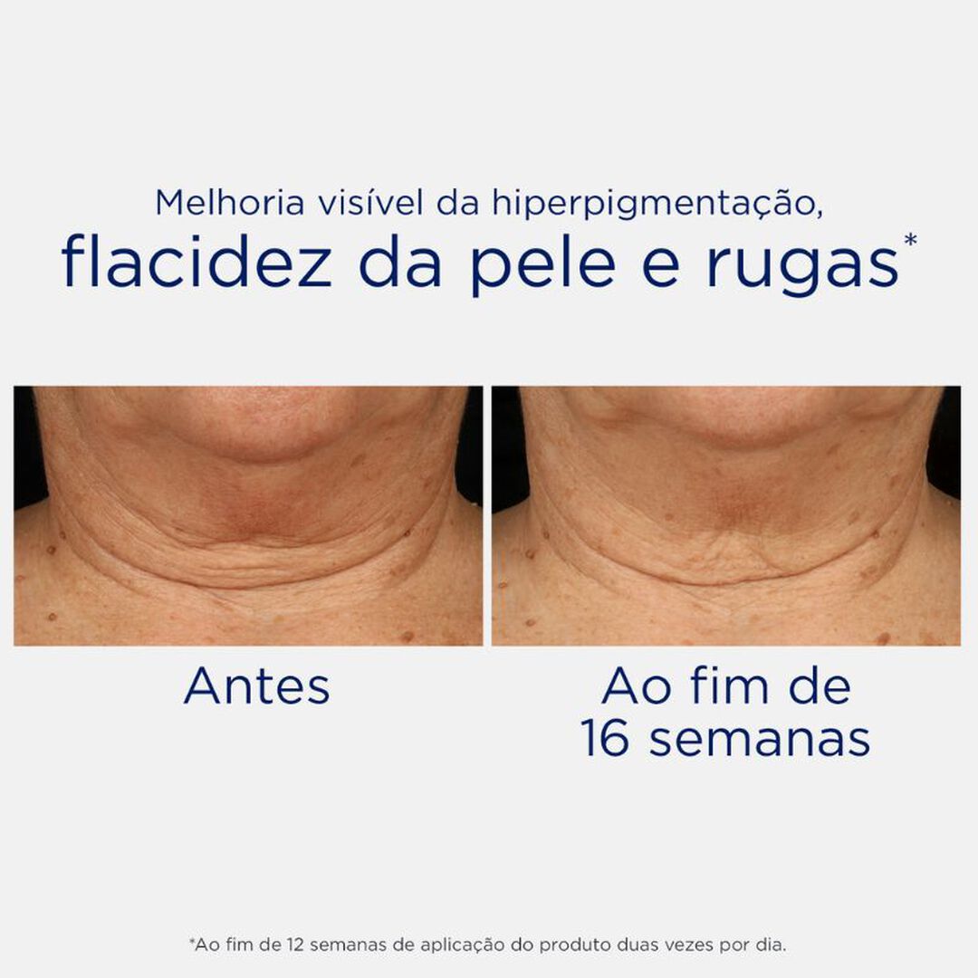 NEOSTRATA  Skin Active - Creme Triplo Refirmante para o Pescoço e Decote - 80gr