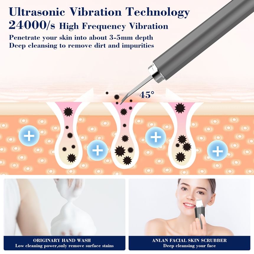 ANLAN - Ultrasone huidreiniger - 2 kleuren
