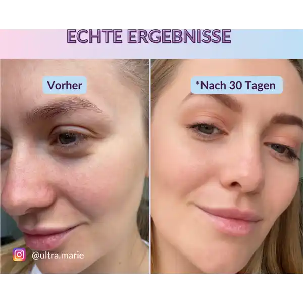 Hyaluronic Facial Serum