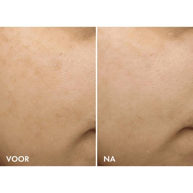 Vichy Liftactiv B3 RetinolNachtcreme 50ML