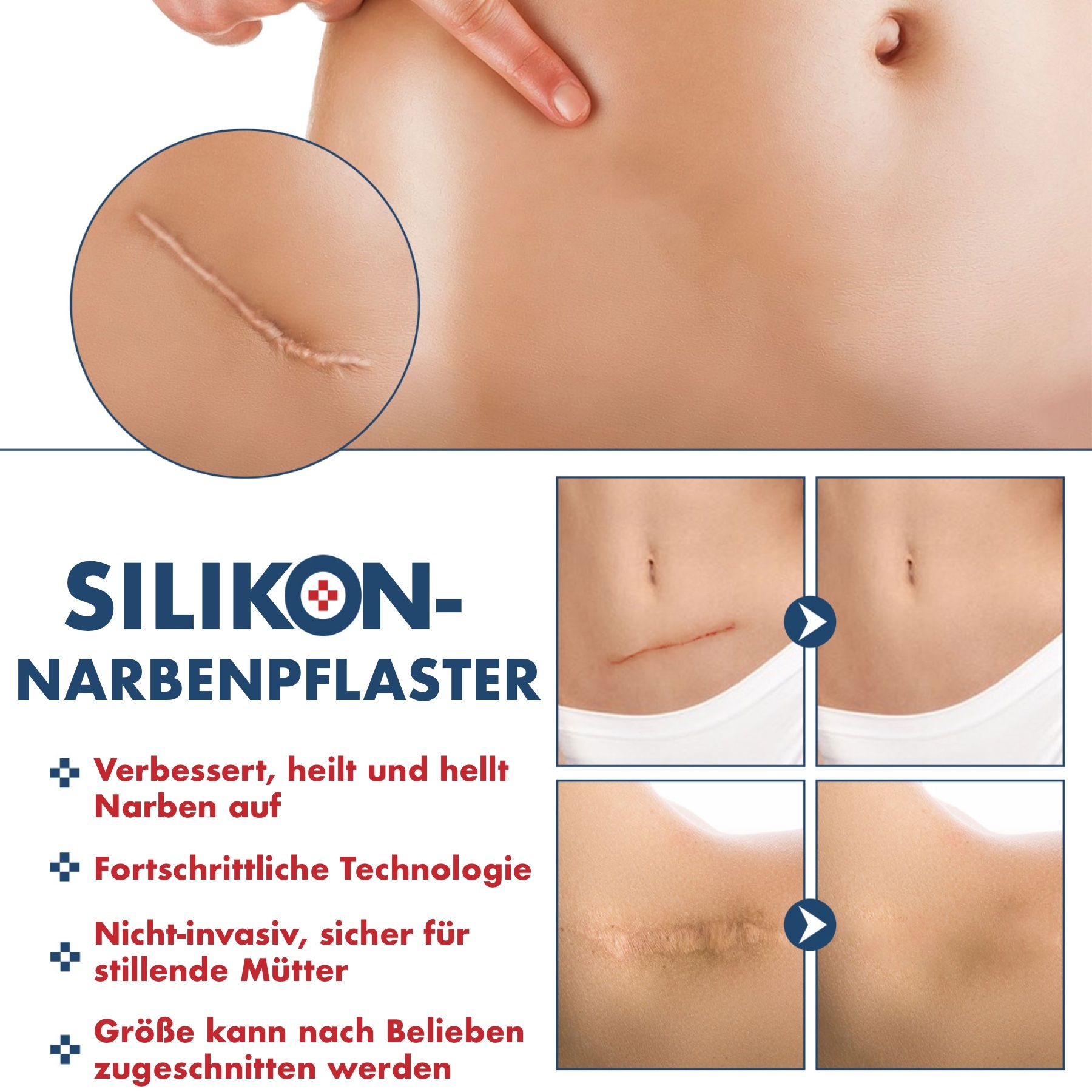 P-Beauty Wundpflaster für Narben