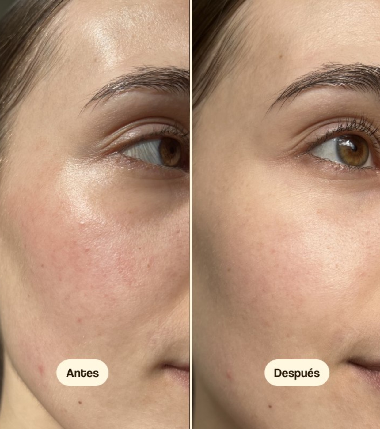 Freshly Cosmetics - Creme Hidratante Diurno Centella Asiatica CICA Calm - Pele seca e sensível