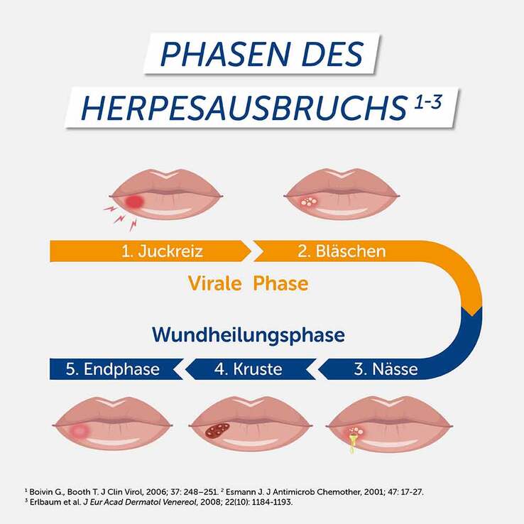 Pencivir bei Lippenherpes Creme, 2 g