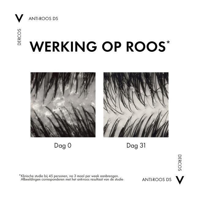 Vichy Dercos Anti-Roos Shampoo Droog Haar 390 ML