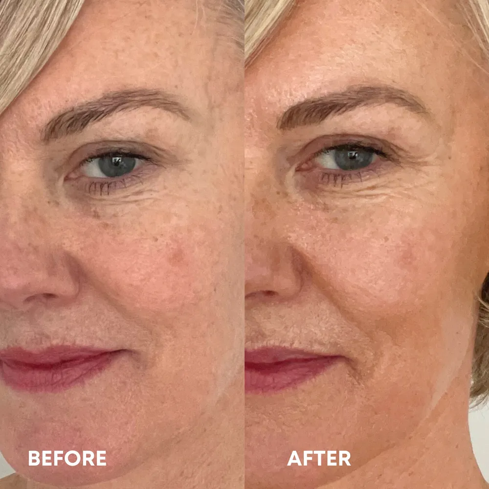 Vita Liberata Beauty Blur Face Light - 30 ml.