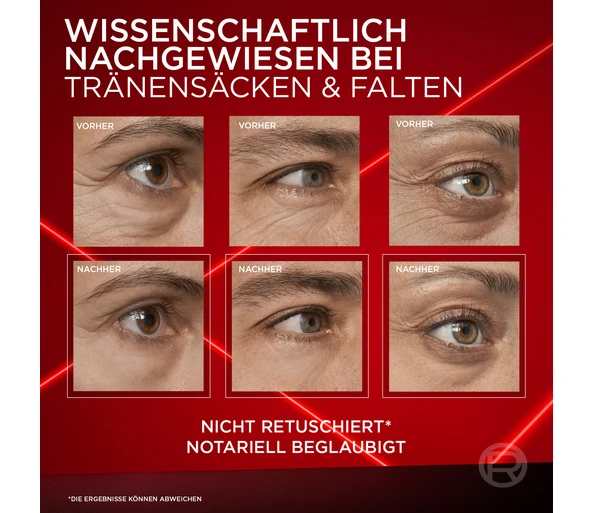 L'ORÉAL PARIS Revitalift Laser Anti-Tränensack Sofort Lifting Augenpflege