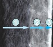 Dennerle Nano Clean Hoekfilter uitbreidingsbundel