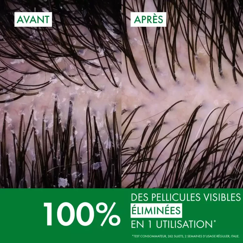 Dercos Technique Antipelliculaire DS Shampooing traitant pellicules & démangeaisons cheveux secs - 200ml