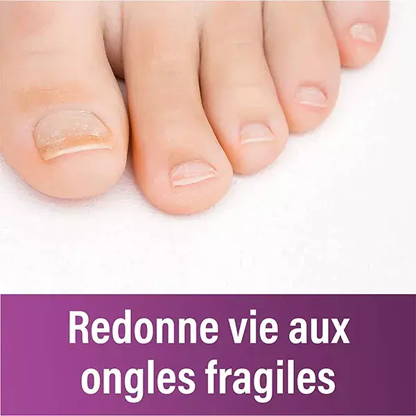 Emtrix® Night Patch - Tratamento para Micose de Unhas - 14 adesivos