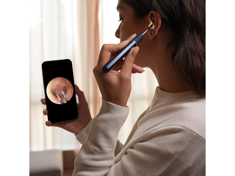Bebird Ohrenreiniger Note 5 Pro Blau Ohrenschmalzentferner mit Kamera