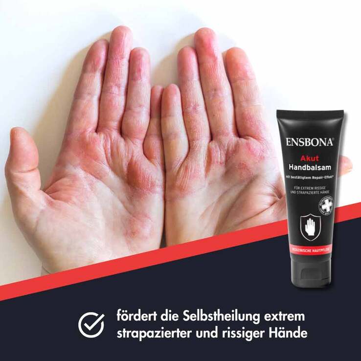 Handbalsam Akut Ensbona, 75 ml