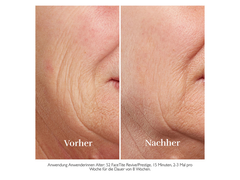 FaceTite Essentials antiverouderingsapparaat H2120/H2130