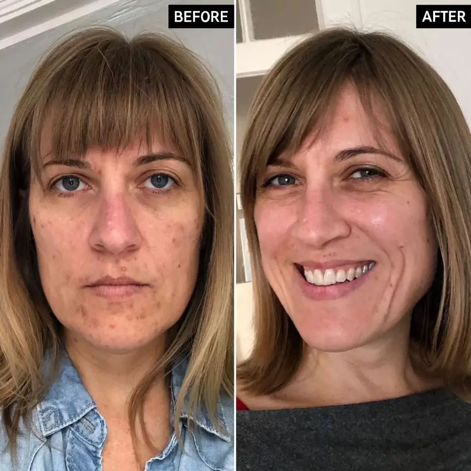 Retinol Serum