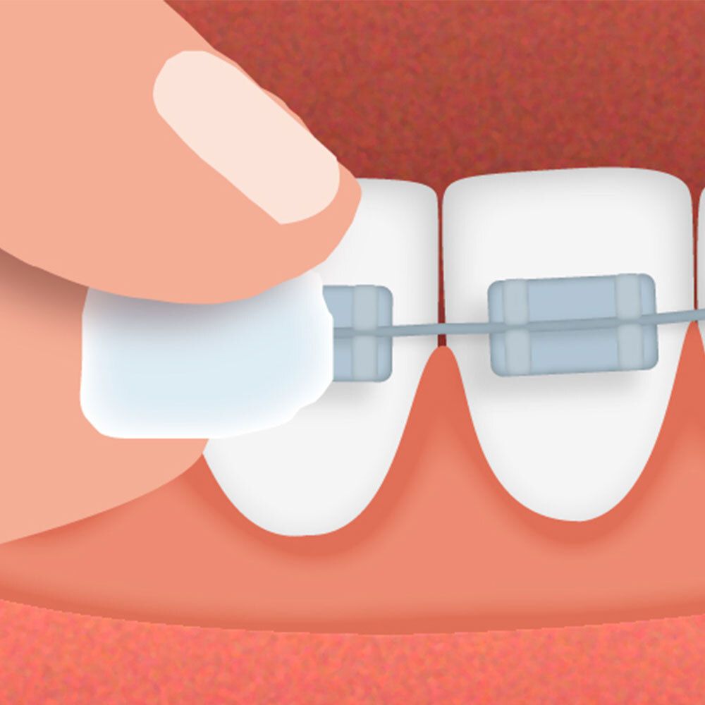 GUM® Ortho Wachs Mint 723