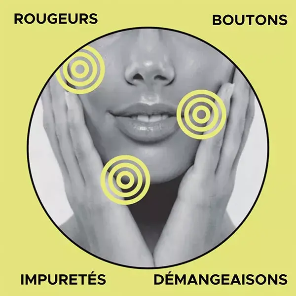 Sowé Roll-On Réparateur Anti Imperfection Stop Bouton Bio 5ml