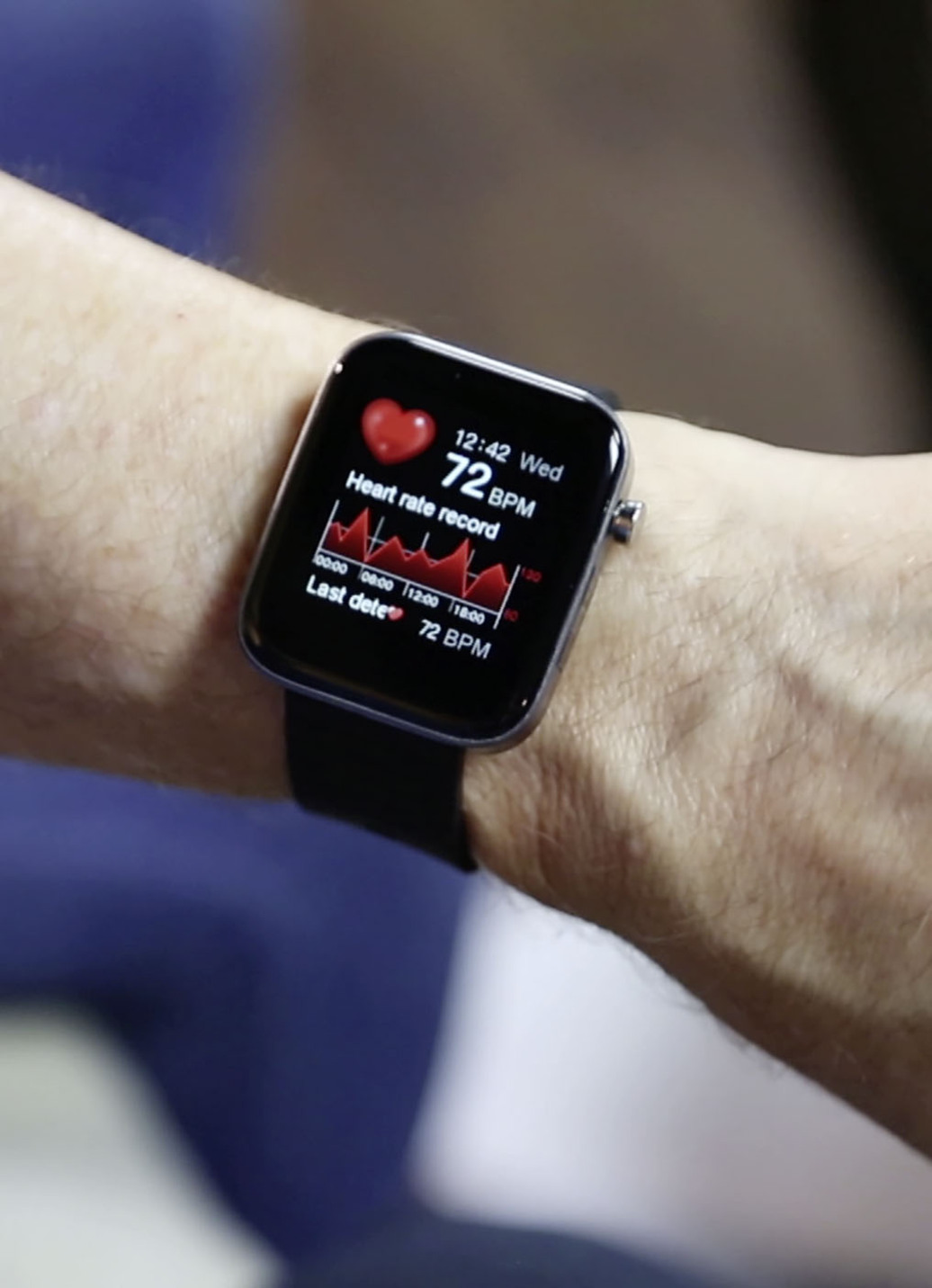 Smartwatch