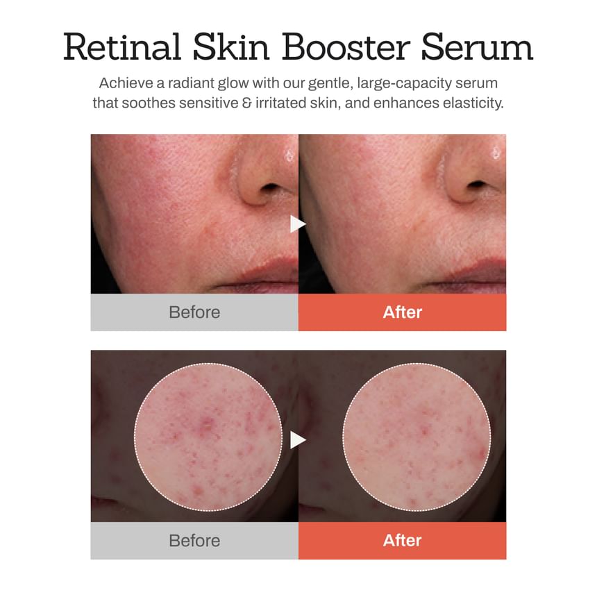Meditherapie - Retinal Skin Booster Serum