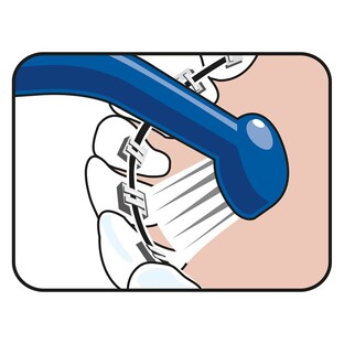 TePe Universal Care - Speciale Tandenborstel 1ST