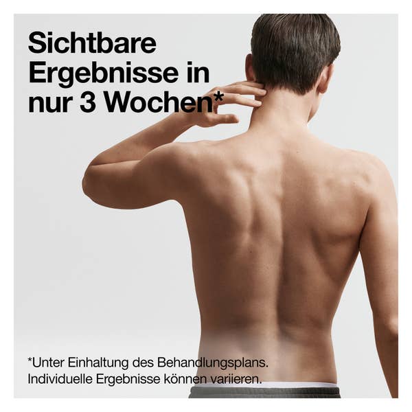 Braun IPL Silk·expert Pro 5 PL5145, Haarentfernung für zuhause, mit Aufbewahrungstasche
