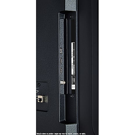 LG 75