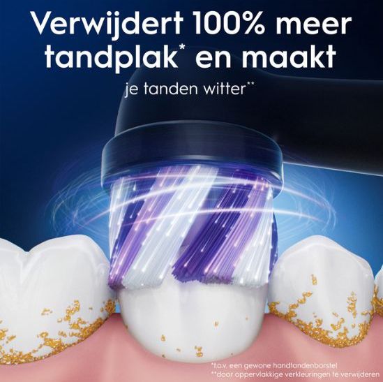 Oral-B - iO RADIANT Opzetborstels - Zwart - 4 Stuks