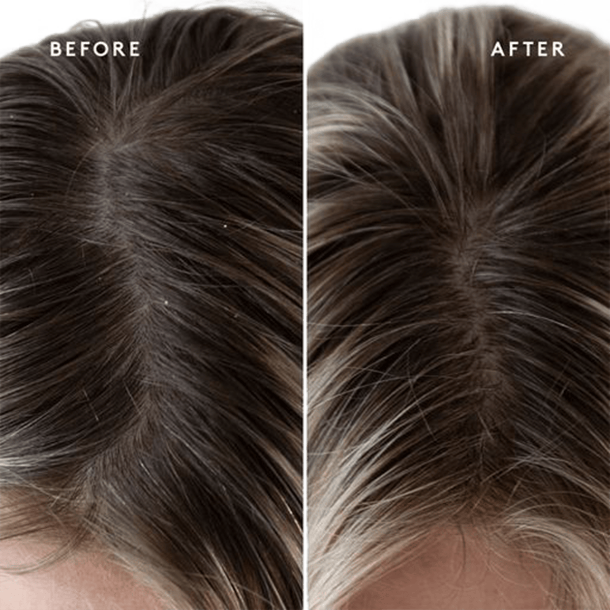 Exfoliating Scalp Treatment 150ml