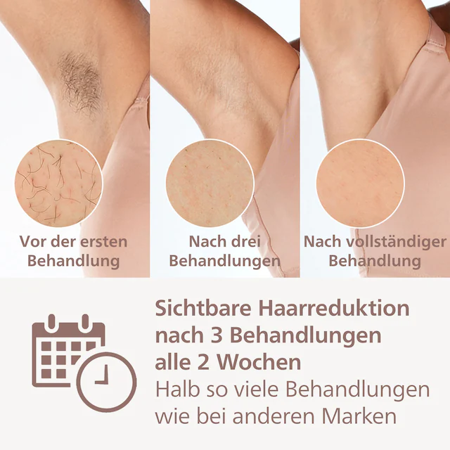 Philips IPL-Haarentferner »Lumea S8000 BRI947/00« 450.000 Lichtimpulse 4 Aufsätze (Achseln, Bikinizone, Körper und Gesicht)