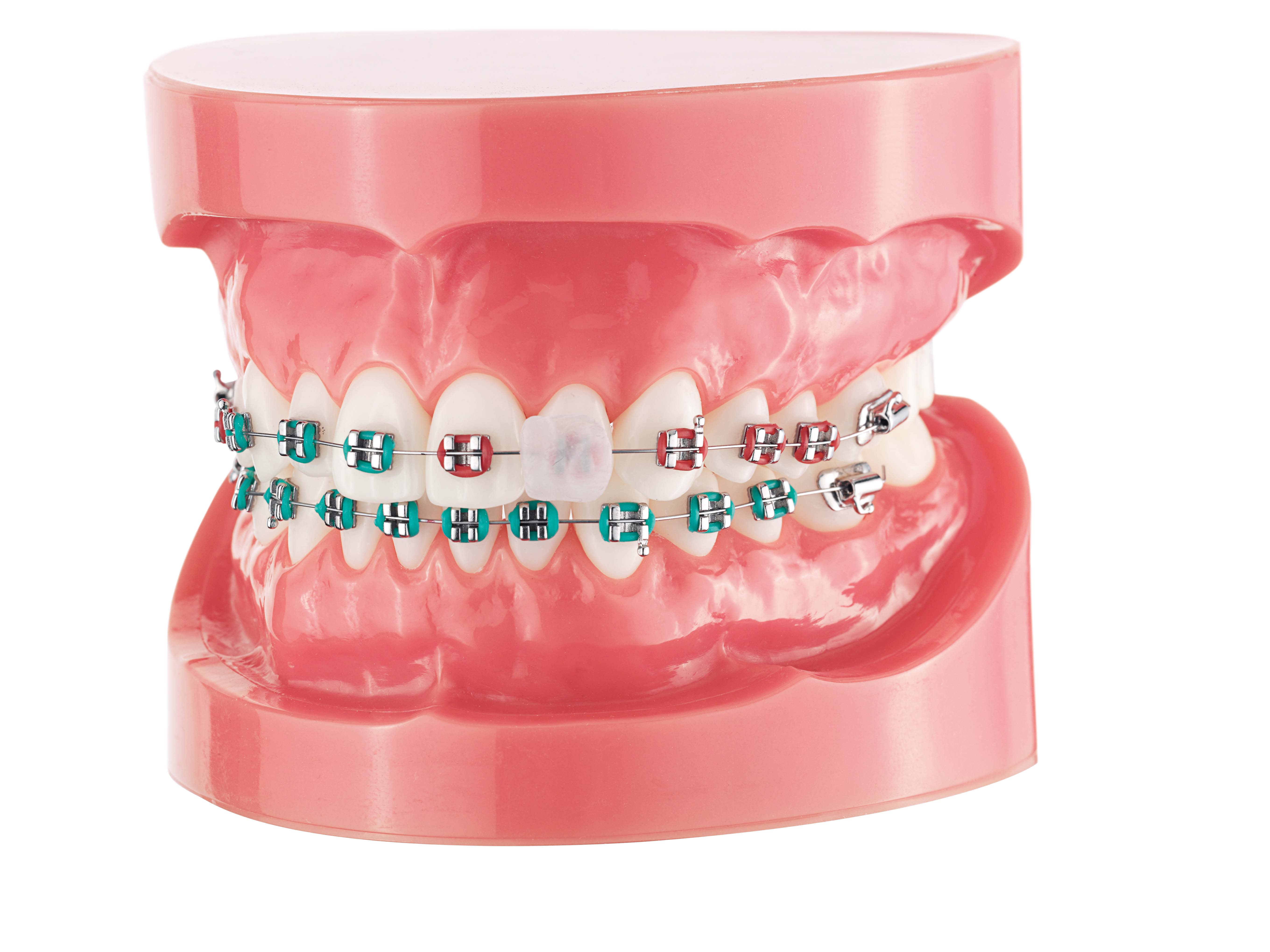 CURAPROX Orthodontischer Wachs 1 Stk