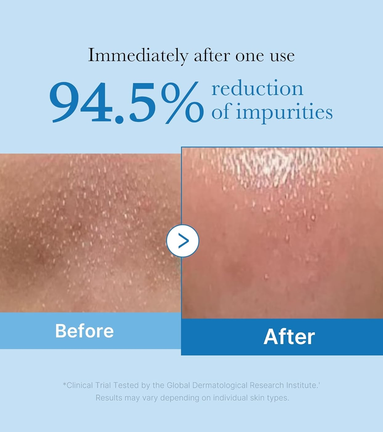 Medicube - *Zero Pore* - Óleo de Limpeza Blackhead Deep