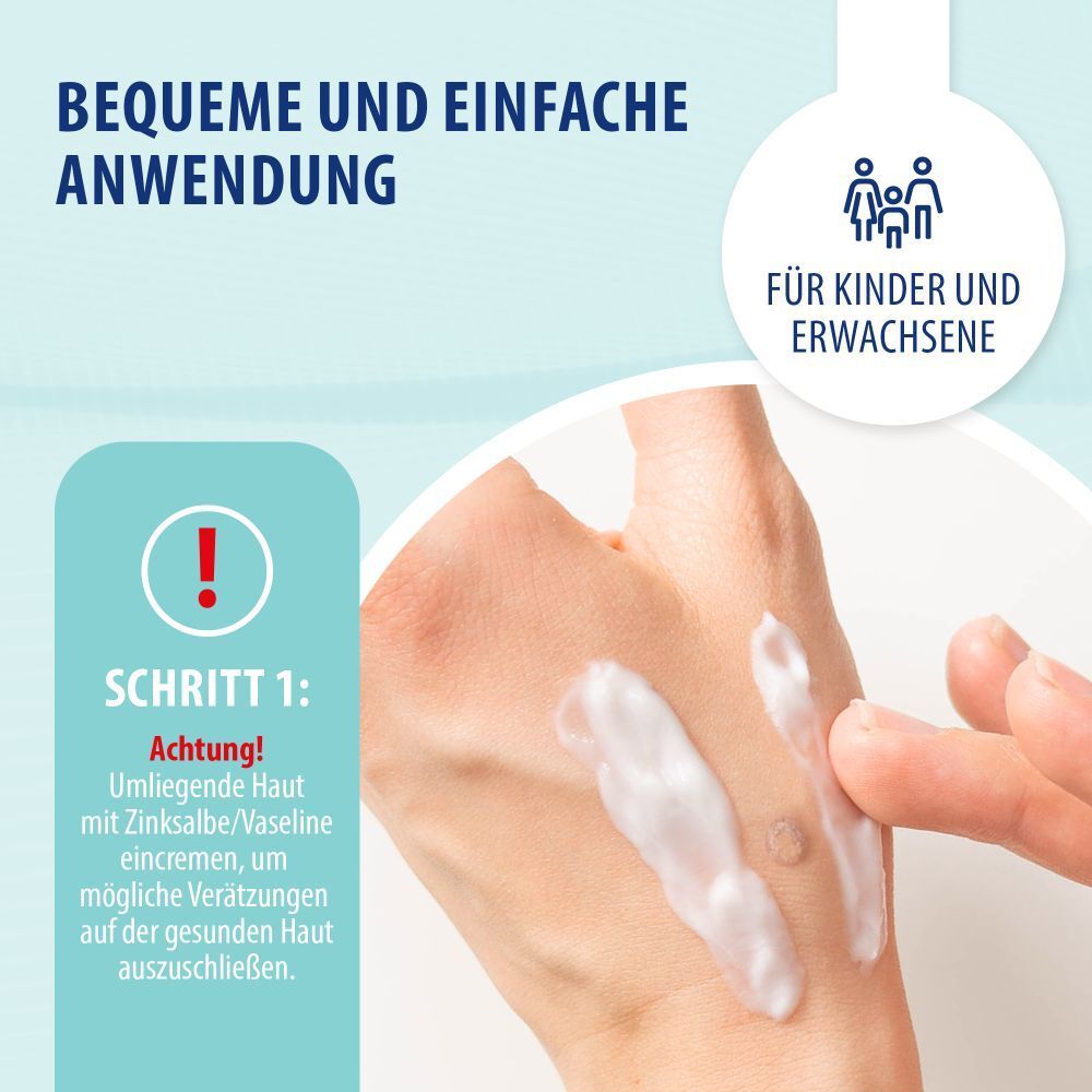 Behrend Warzenmittel für Hand & Fuß - Effektive Warzen Verätzung ohne Schmerzen -  Hygienisch & sicher