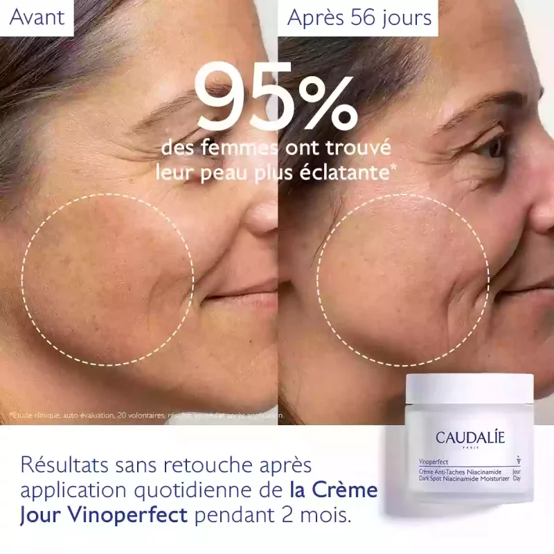 Vinoperfect Crème Anti-Taches Niacinamide - 50ml
