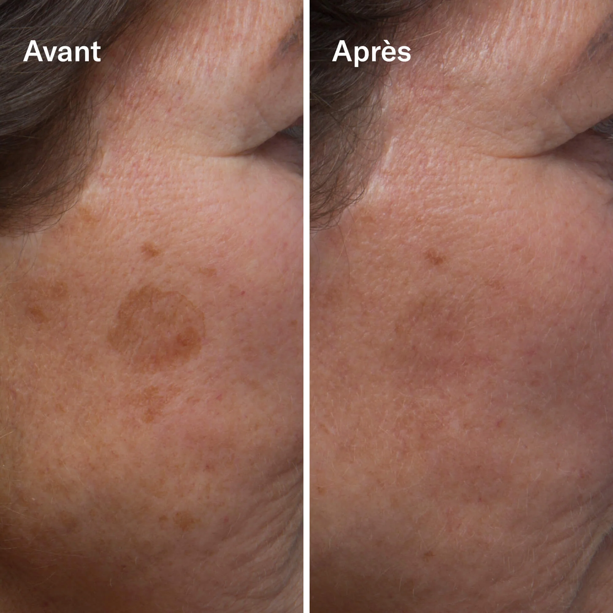Odacité Clean-ical Brightening Serum Sérum Éclaircissant