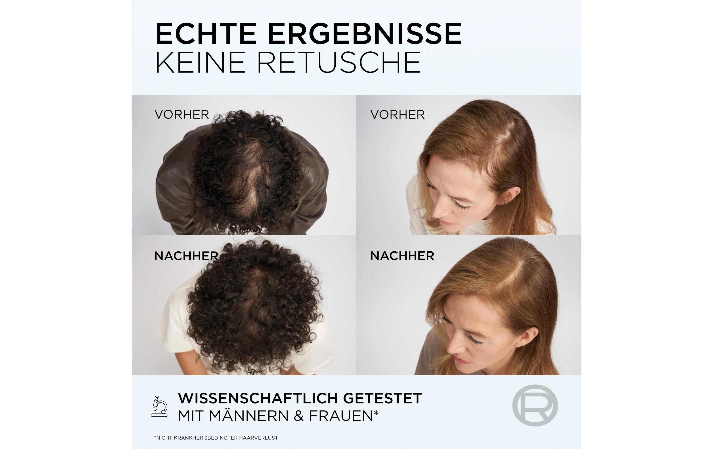 Shampoo Fiber Booster Anti-Haarverlust 200 mlHaarshampoo schützt vor unterschiedlichen Ursachen von Haarverlust und Haarbruch