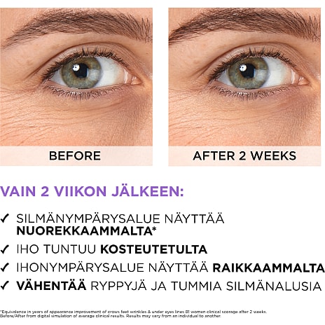 Øjenserum