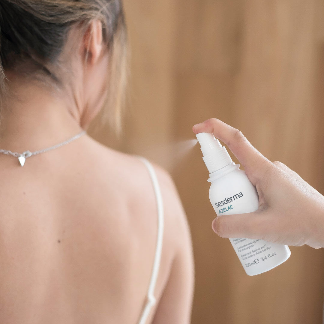 SESDERMA  Azelac Loção Corporal - 100ml