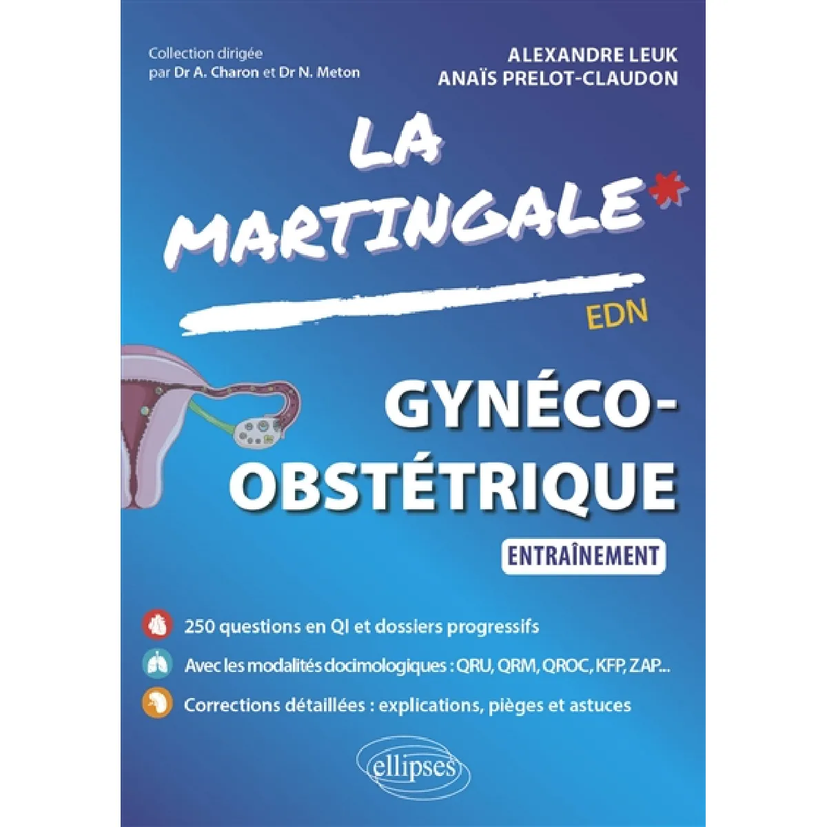 La martingale. Gynéco-obstétrique : entraînement : EDN