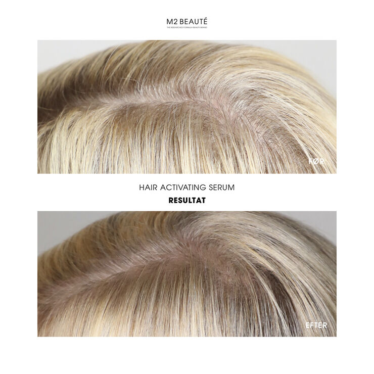 M2 Beauté Hair Activating Serum