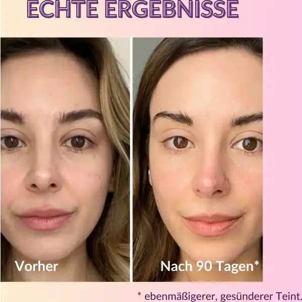 Vitamin C Moisturizer
