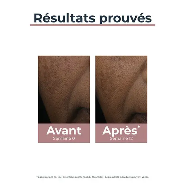 Eucerin Anti-Pigment Correcteur de Taches 5ml