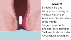 SULGAN N Suppositorien, 10 Stück