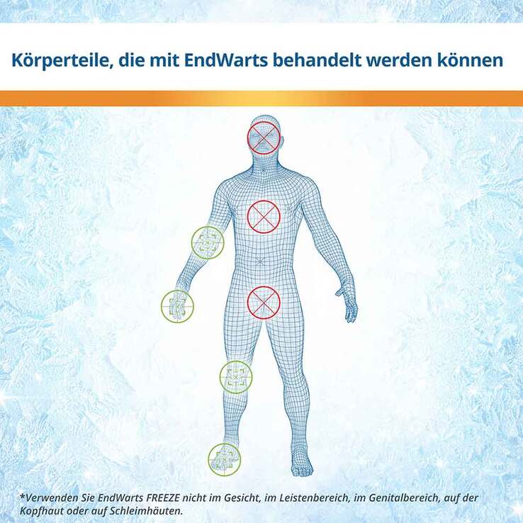 EndWarts® FREEZE Spray, 7.5 g