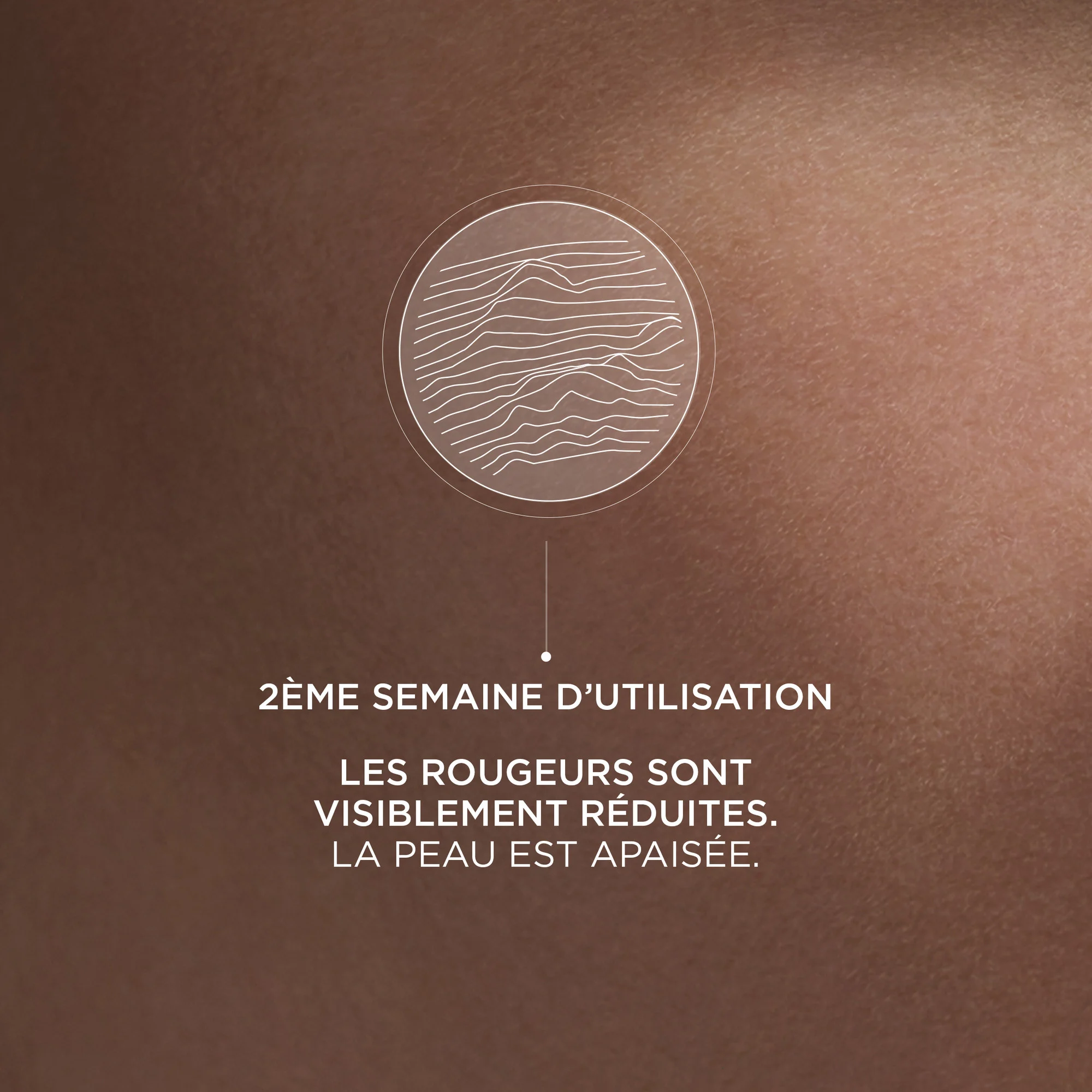 Intral - Super Concentré S.O.S. |