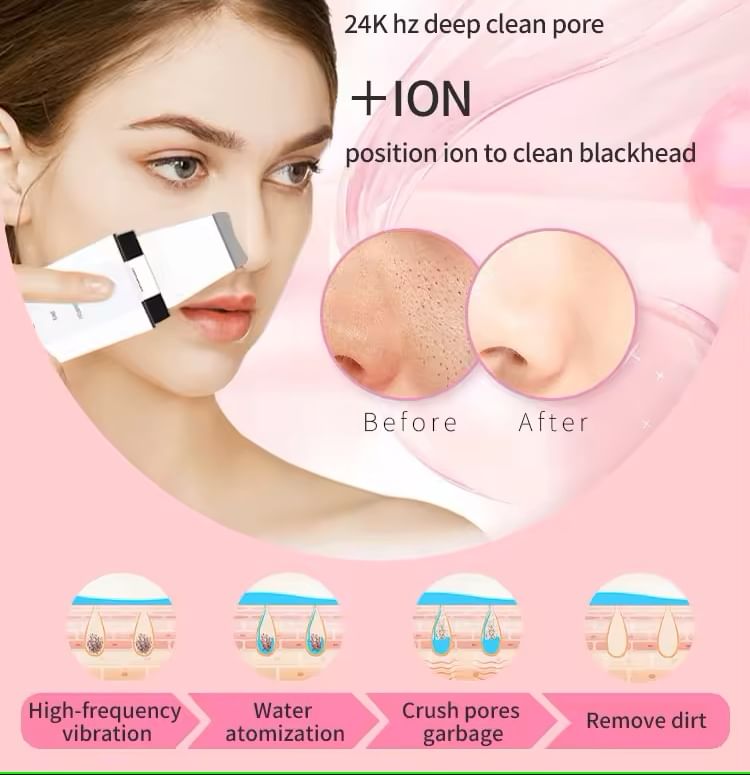 Beautyronics - USB oplaadbare EMS gezichtsreinigingsspatel