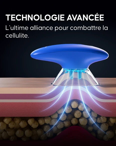 Ventouse Anti-Cellulite Électrique