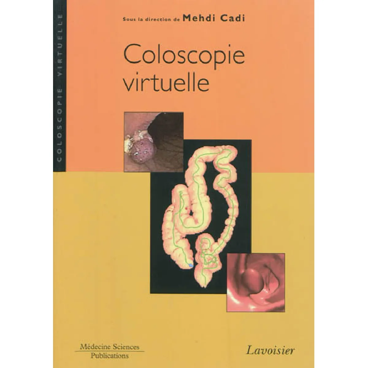 Coloscopie virtuelle · Occasion